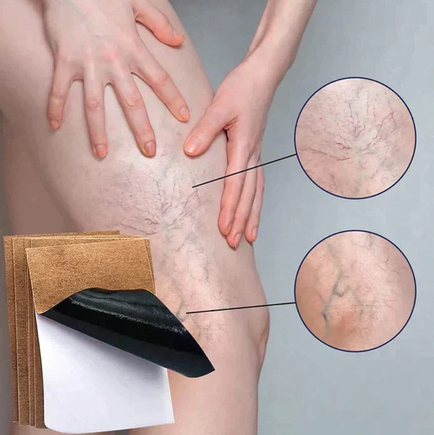 PARCHES PARA VARICES