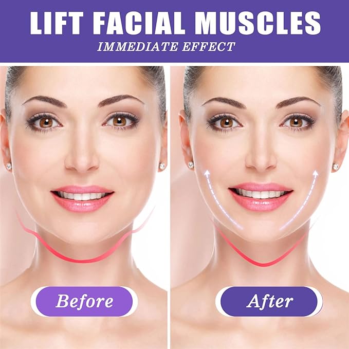 CINTA PARA LIFTING FACIAL